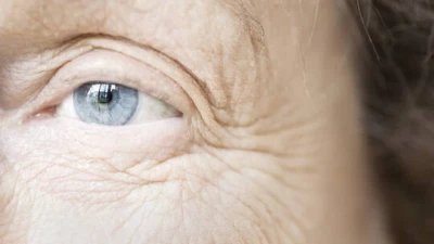 بالصورة.. الكشف عن ما يمكن أن تسببه 28 سنة من أضرار أشعة الشمس على الوجه