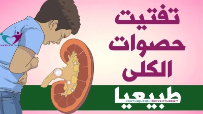وداعًا لجهاز تفتيت الحصى.. أطباء عالميون يكشفون عن فاكهة لها قدرة سحرية في إنهاء مشاكل الكلى وتخليص الجسم من السموم في أقصر وقت..لن تصدق ماهي