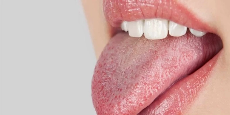 "3 علامات في الفم تكشف عن خطر مرتفع لارتفاع نسبة السكر في الدم! اكتشفها الآن ولا تضيع الفرصة"